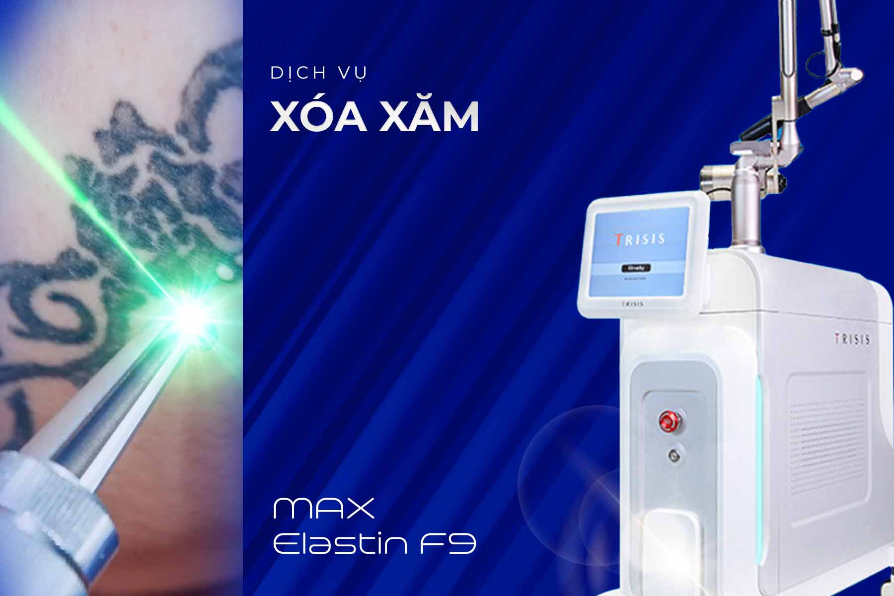 dich-vu