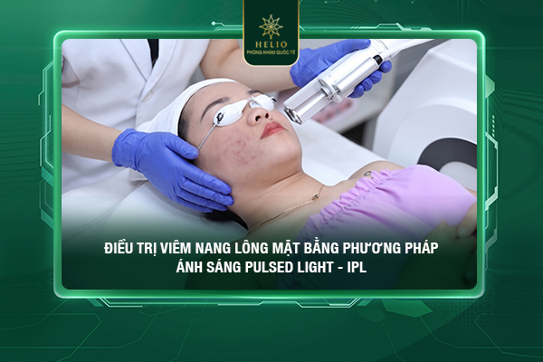 viem-nang-long-o-mat