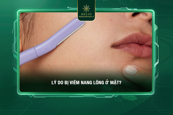 viem-nang-long
