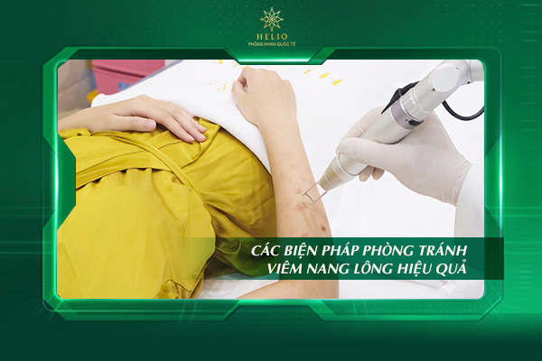 viem-nang-long