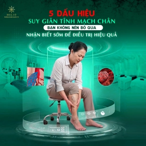 5 DẤU HIỆU SUY GIÃN TĨNH MẠCH CHÂN BẠN KHÔNG NÊN BỎ QUA | NHẬN BIẾT SỚM ĐỂ ĐIỀU TRỊ HIỆU QUẢ