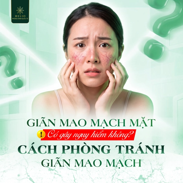 GIÃN MAO MẠCH MẶT CÓ GÂY NGUY HIỂM KHÔNG? CÁCH PHÒNG TRÁNH GIÃN MAO MẠCH