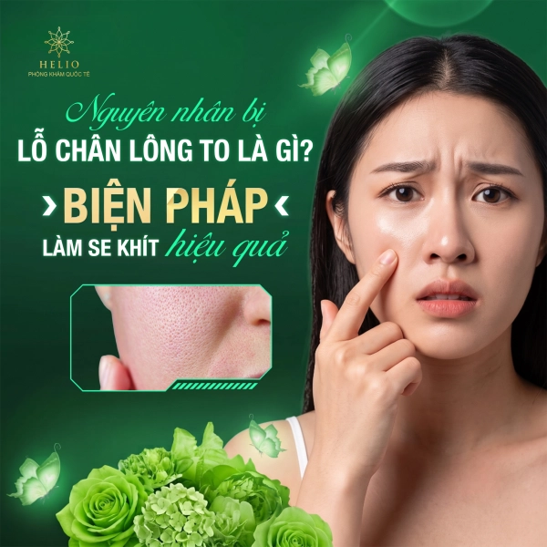 NGUYÊN NHÂN BỊ LỖ CHÂN LÔNG TO LÀ GÌ? BIỆN PHÁP LÀM SE KHÍT HIỆU QUẢ