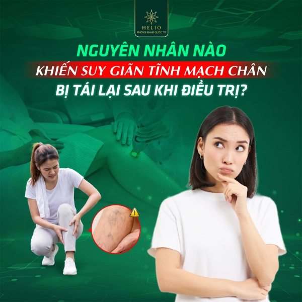 NGUYÊN NHÂN NÀO KHIẾN SUY GIÃN TĨNH MẠCH CHÂN BỊ TÁI LẠI SAU KHI ĐIỀU TRỊ?