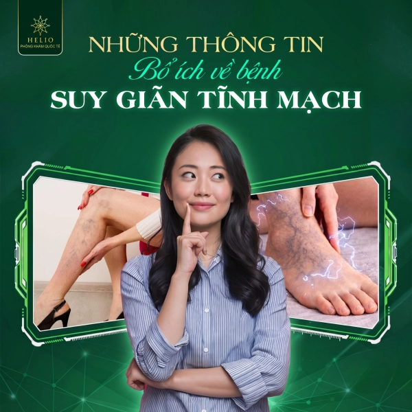 NHỮNG THÔNG TIN BỔ ÍCH VỀ BỆNH SUY GIÃN TĨNH MẠCH